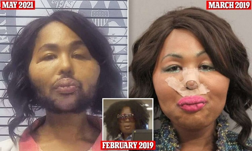 سرقت آلاف الدولارات من المصرف... لتغطية تكاليف عمليات التجميل في المكسيك!