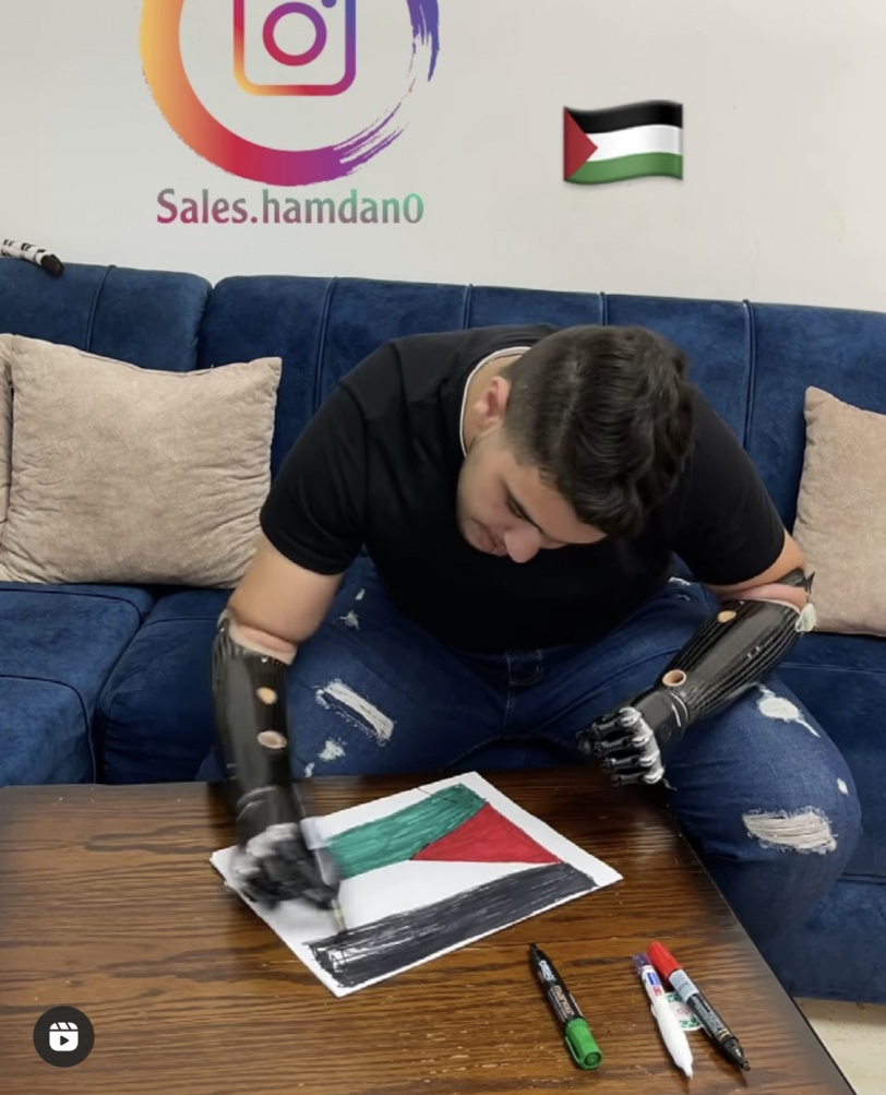 “فتى الزرقاء” يعود بقوة بذراعيه الاصطناعيتين