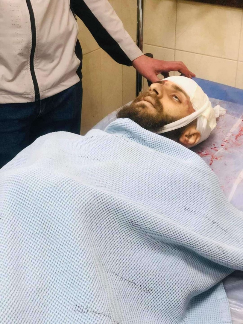 شهيد وإصابتان خلال اقتحام الاحتلال مخيم الفارعة