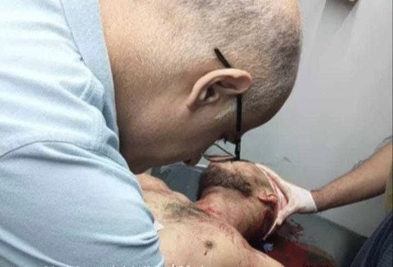 افرج عنه من سجون الاحتلال قبل أيام...استشهاد شاب خلال مواجهات مع الاحتلال في بيت أمر