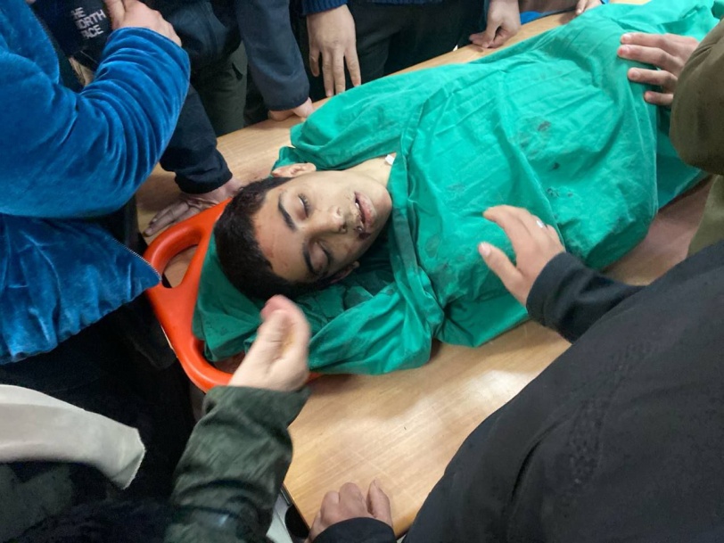 استشهاد فتى متأثراً بإصابته بقصف للاحتلال على طمون