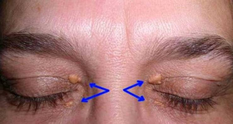 سورة في القرآن تقضي على مشكلة النسيان والزهايمر