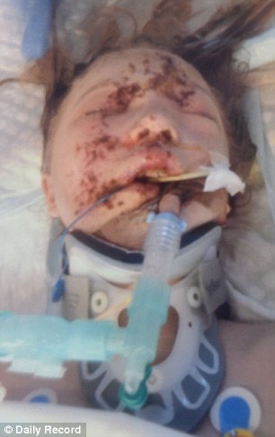 3217517900000578-0-Miss_Thomson_pictured_in_2008_after_having_her_face_removed_for_-a-35_1457965712639