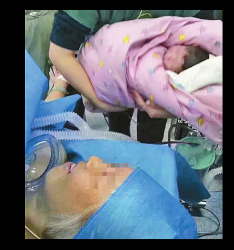 صور.. صينية تنجب طفلاً وهي في الـ64 من العمر