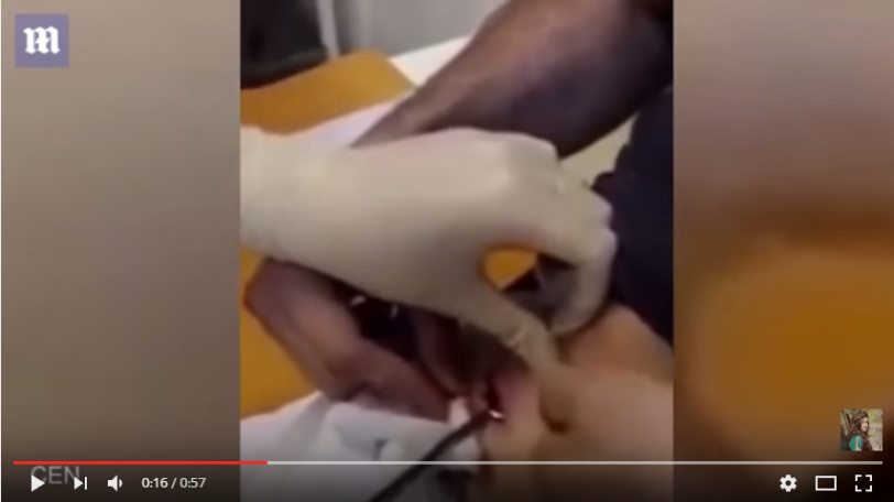 بالفيديو: شاب يخطب حبيبته الممرضة بخاتم خبأه في معدته