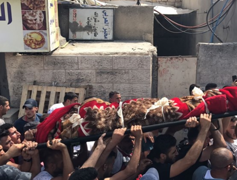 سبب ظهور الشعر الأبيض قبل الثلاثين