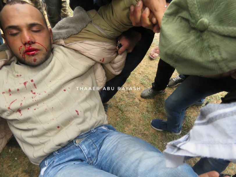 محدث: 16 شهيدا وأكثر من 1400 جريح في غزة