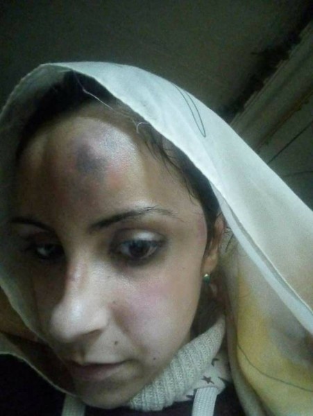 أسرة مصرية تبرح طليقة ابنهم ضرباً.. والسبب لا يصدّق