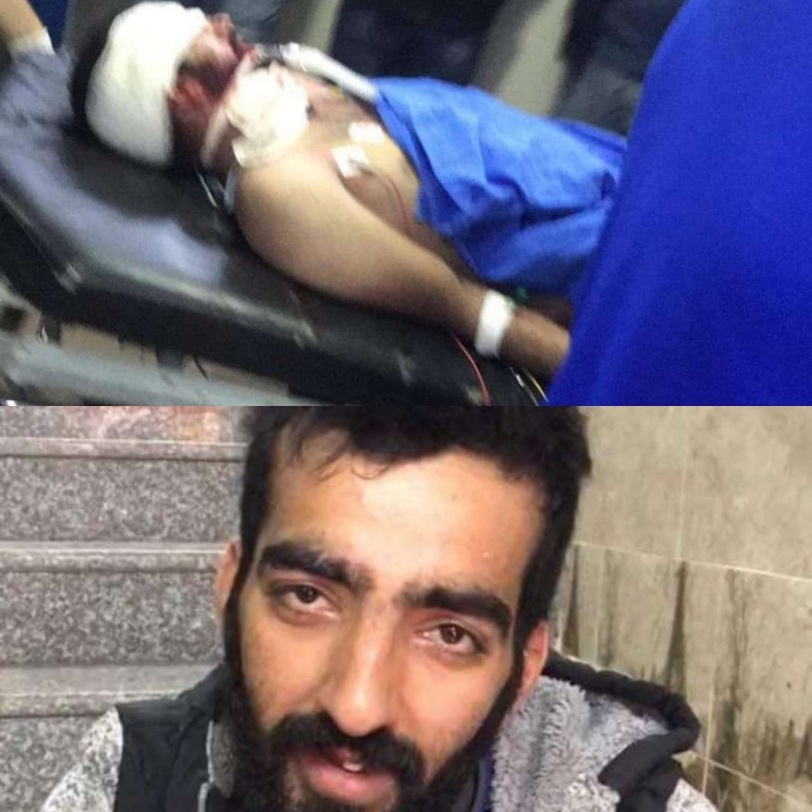 إستشهاد شاب برصاص الإحتلال في طولكرم