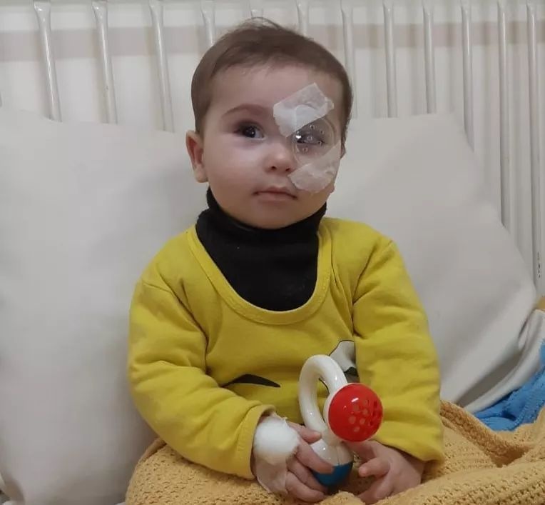 طبيب فلسطيني يعيد البصر لرضيع من غزة