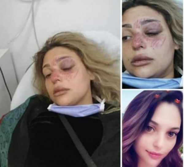 بعد وفاة زوجها الفلسطيني.. تعنيف تونسية في الأردن يثير جدلاً والسلطات تتدخل